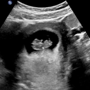 2D9wks
