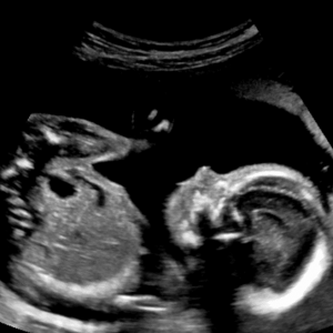 Cotton Candy Sky Cotton Candy Sky