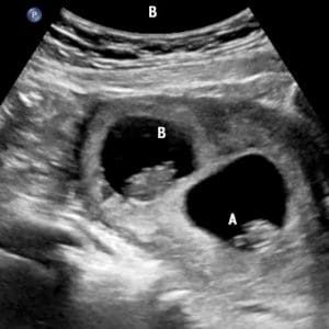 Double Love 2025 Double Love 2025