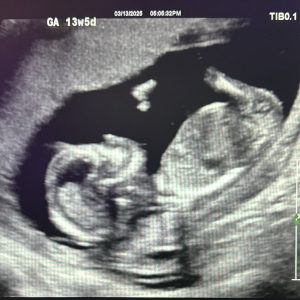Early Pregnancy