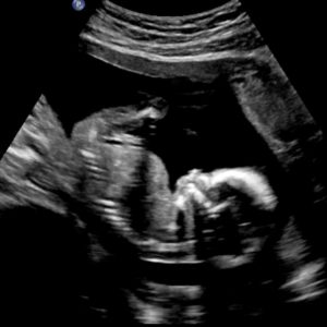 Peek A book Peek A book